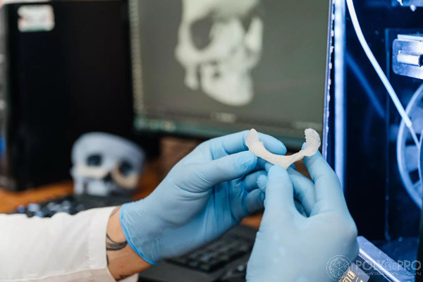 Имплантаты из фторопласта создали в Томске на 3D-принтере