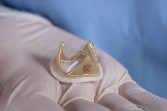 Первый полимерный сердечный клапан установили пациенту в Австралии